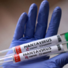 Hantavirus: qué es, síntomas y cómo se transmite
